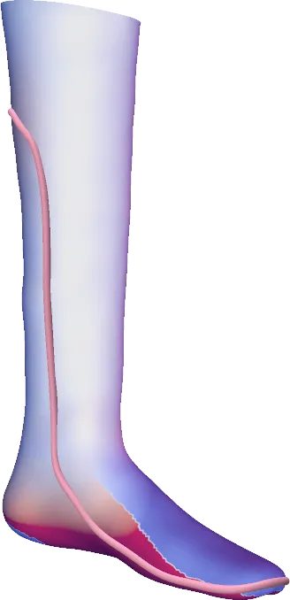 Ankle-Foot Orthosis