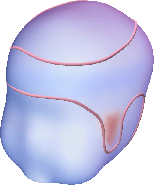 Cranial