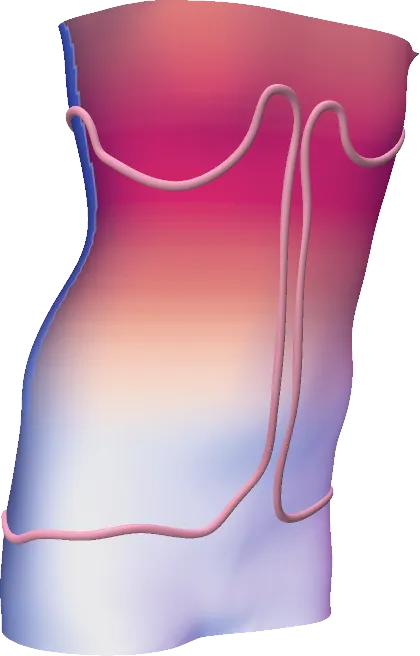 Spinal