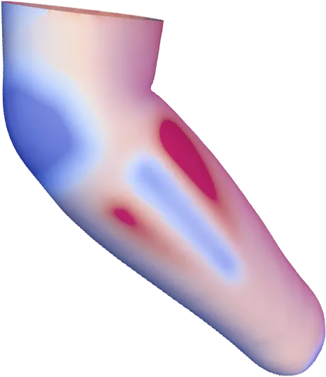 Transradial Socket